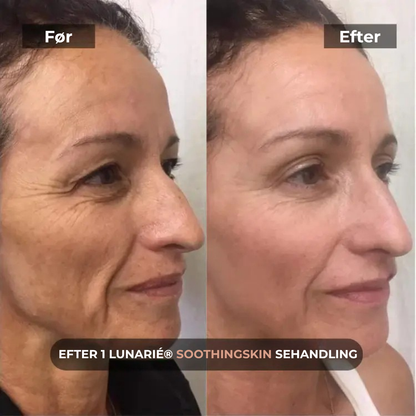 Lunarié® SoothingSkin | Glöd Som Aldrig Förr – Den Banbrytande Anti-Aging Genombrottet för Hemmet är Här!