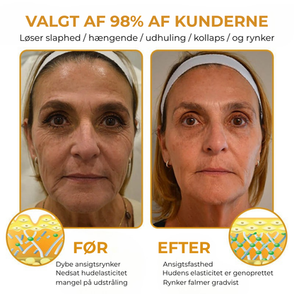 BeeGlow® | Den kraftfulla anti-aging lösningen designad för alla hudtyper och alla åldrar.