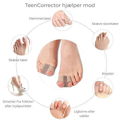 FlexiToe® | Skonsam tåjustering för daglig lindring