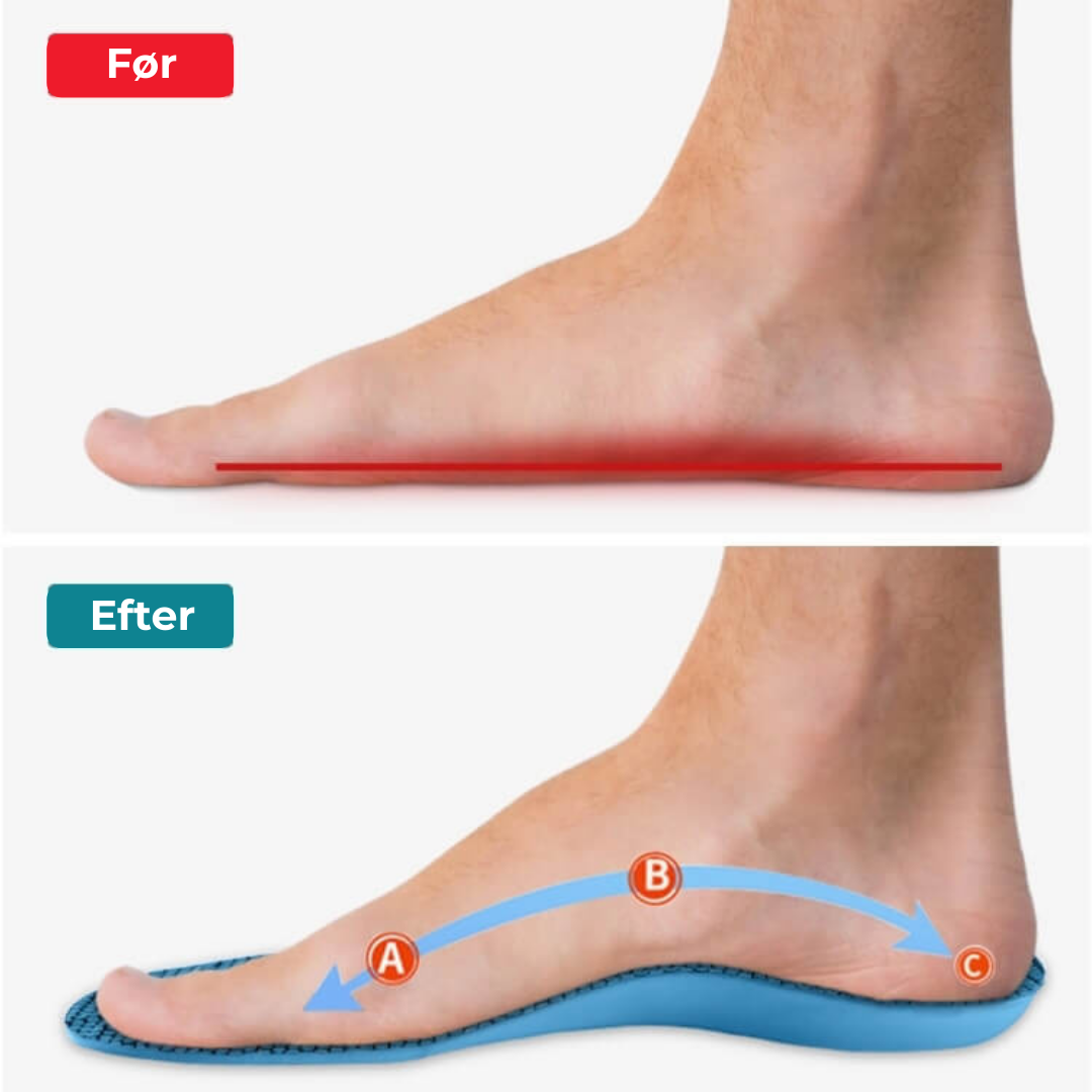 FodLind® | Trött på fotsmärtor? Upplev de revolutionerande FodLind® inläggssulorna som ger lindring utan medicin!