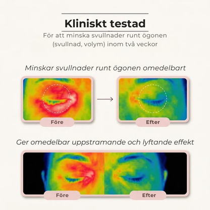 Collira® | Ögonkompresser med peptid- och kollagenhydrogel