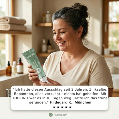 HudLind® | Chafing Relief Cream befriar dig från hudirritation på 7 dagar – utan recept, utan kortison och utan feta krämer som förvärrar problemet.