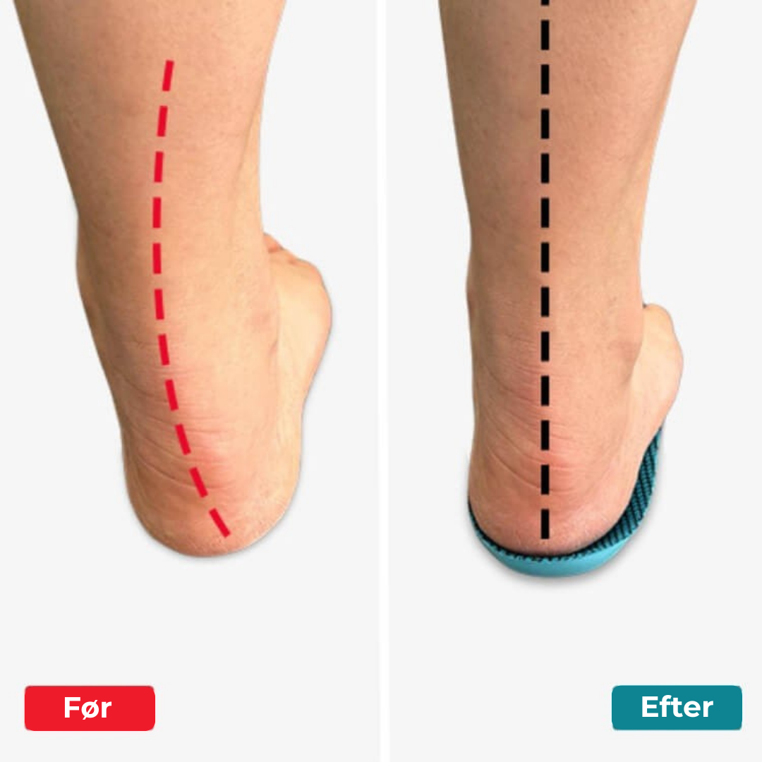 FodLind® | Trött på fotsmärtor? Upplev de revolutionerande FodLind® inläggssulorna som ger lindring utan medicin!