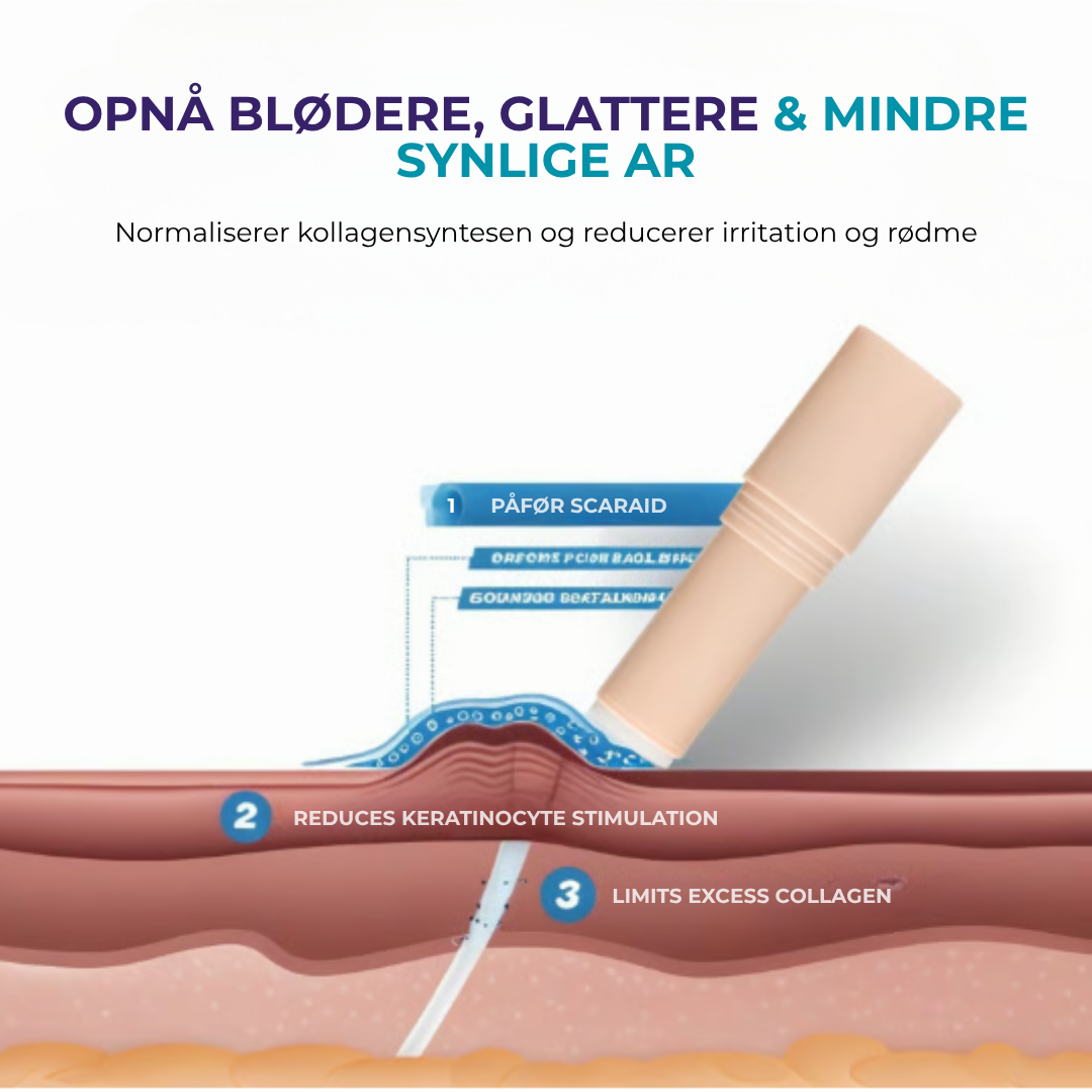 ArFri® Stick | Hud Ar-Lösning🛡️ 60 % Silikon Stick mot Ärr