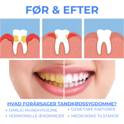 PuraGen® | Friskare tandkött och upp till 95 % vitare tänder på bara 3 dagar!