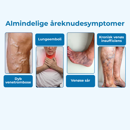 CircuClear® | Ta kontrollen över dina ben tillbaka – synlig lindring på bara 1 vecka