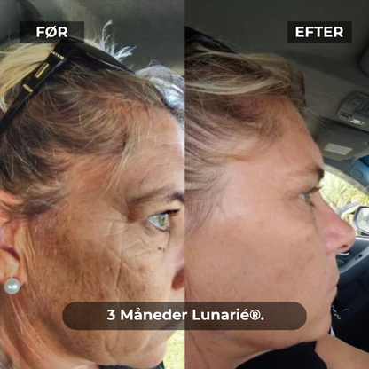 Lunarié® SoothingSkin | Glöd Som Aldrig Förr – Den Banbrytande Anti-Aging Genombrottet för Hemmet är Här!