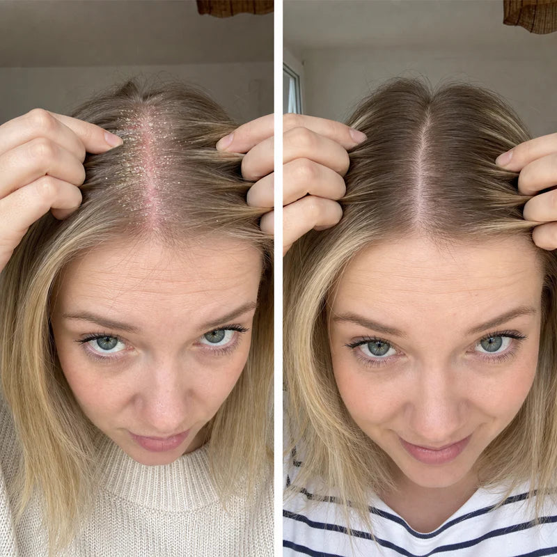 Elin P., 27 år
