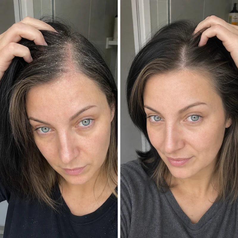 Emma K., 29 år