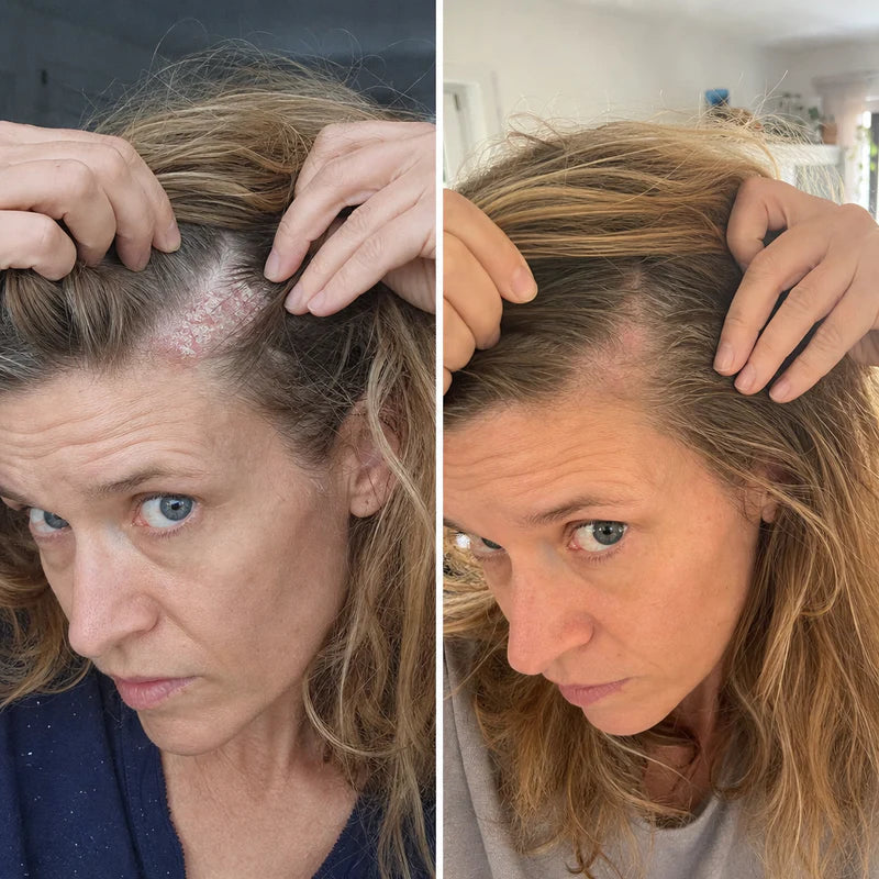 Hanna E., 40 år