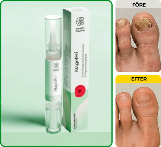 NagelFri® | Sluta gömma dina naglar – bli av med nagelsvamp från roten på bara 12 veckor!