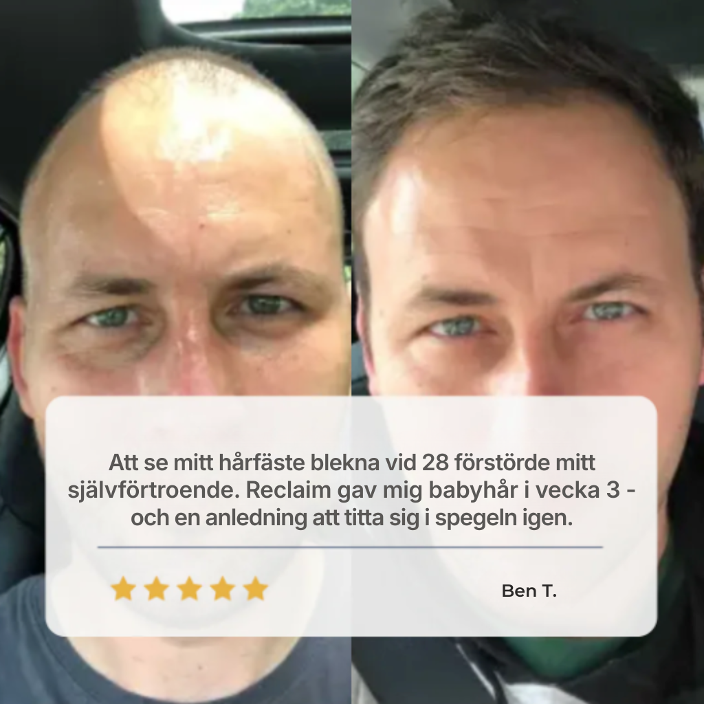 Capora® | Roll-on-serum för hårväxt