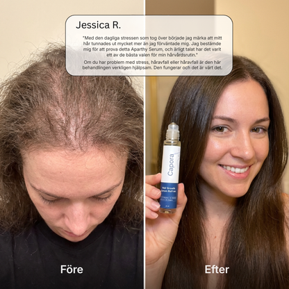 Capora® | Roll-on-serum för hårväxt