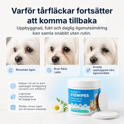 Petelle® Ögonservettsats | förebyggande åtgärder som håller ögonen friska