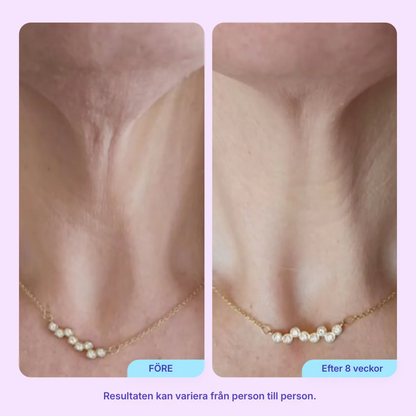 Firmora® | Sculpt & Lift halskräm