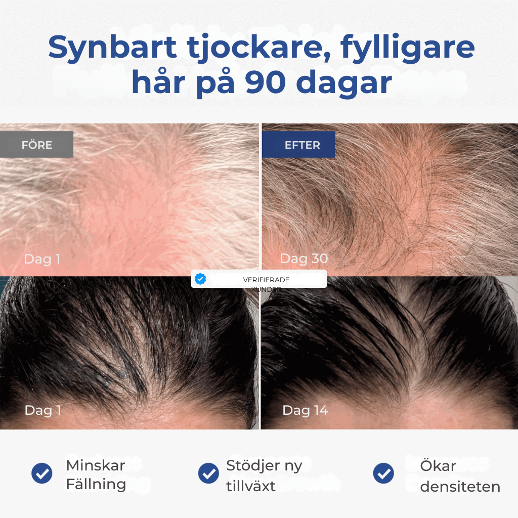 Capilux® | GHK-Cu Kopparpeptidserum | Mindre synligt håravfall & fylligare hår över tid