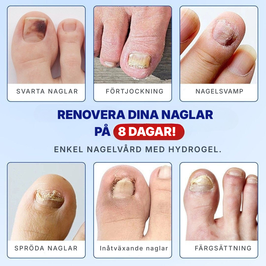 KlarNagel® | Lappar för nagelreparation
