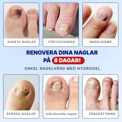 KlarNagel® | Lappar för nagelreparation