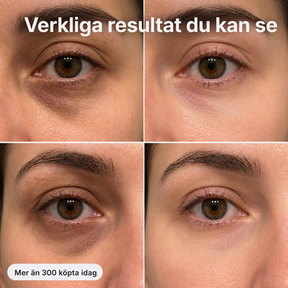 Emvila® | PDRN Collagen Balm – multifunktionellt glow balm för ansikte, hals, läppar och under ögonen
