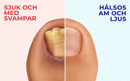 Nailura® | Nagelvårdspenna