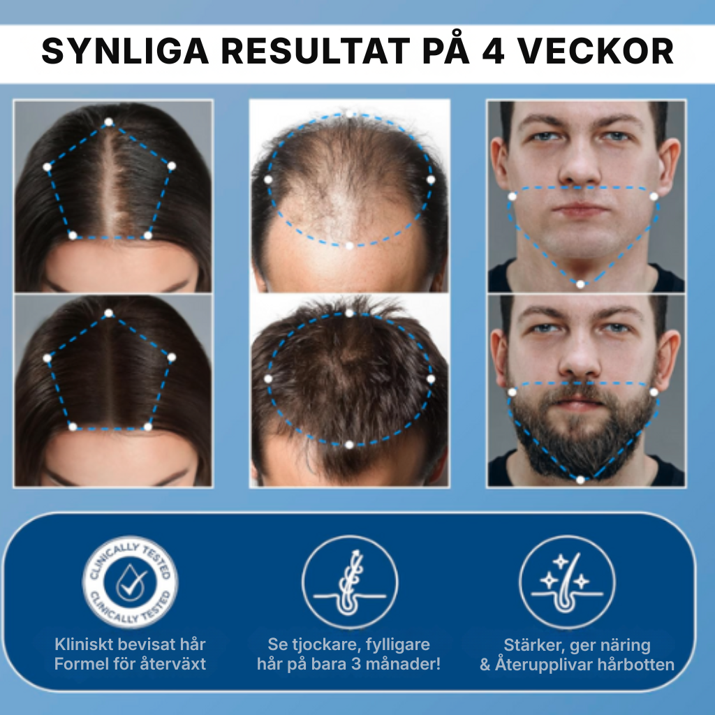 HairVital® | Roll-on-serum för hårväxt