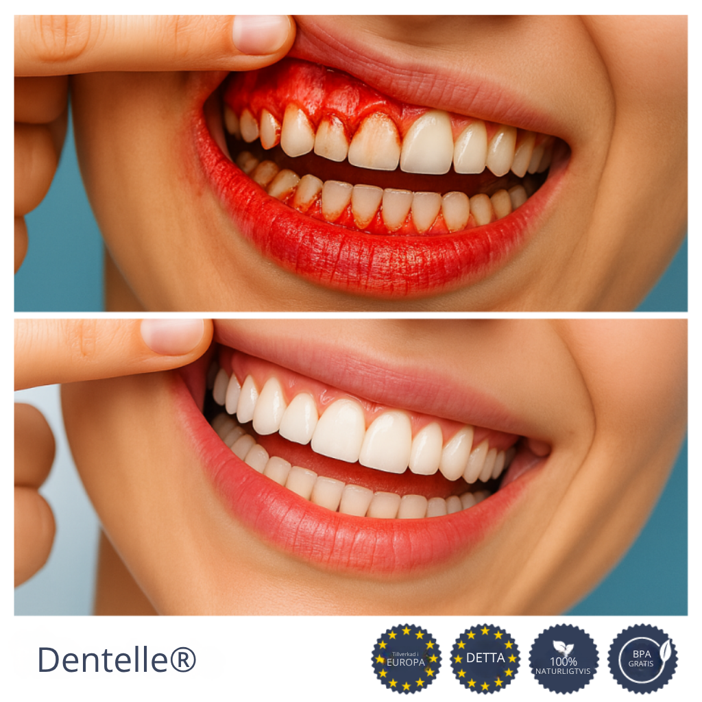 Dentelle® | Återställer tillbakadraget tandkött och gör tänderna vita på bara 3 dagar