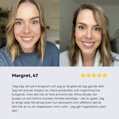 Oralux® | Tandkräm med niacinamid för vitare tänder