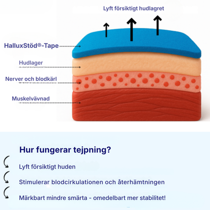 HalluxStöd® | Kinesiotejp vid hallux valgus