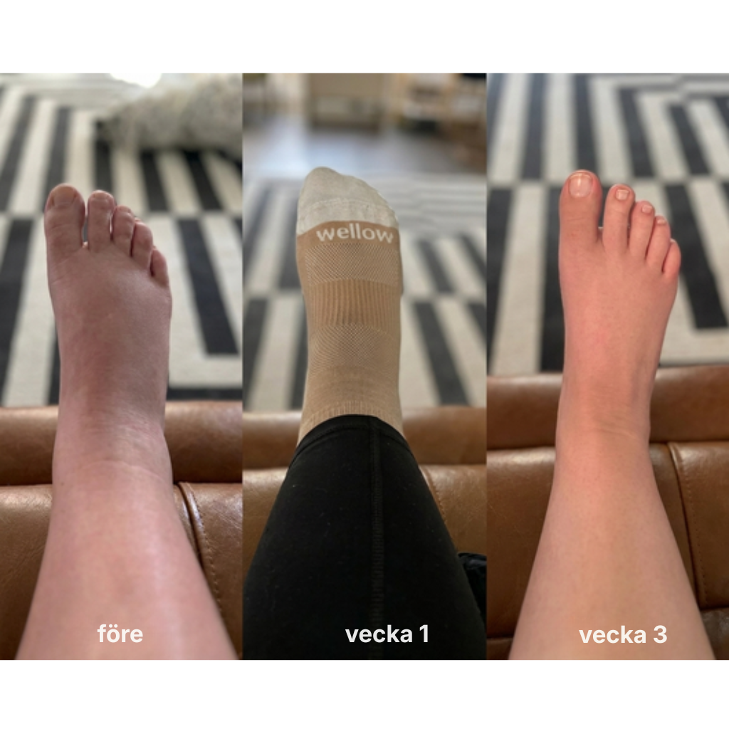 Fluvora® | Liposomala droppar för lymfdränering
