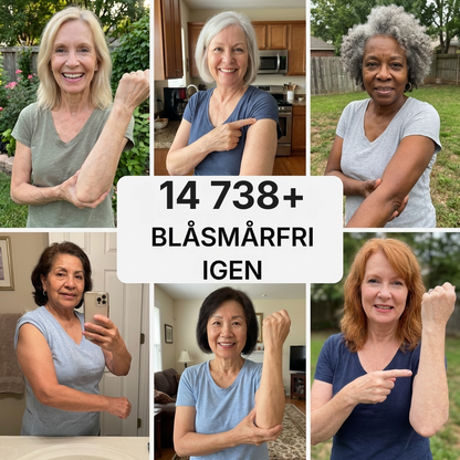 Brusia® | Äntligen en kräm som får blåmärken på känslig hud att blekna
