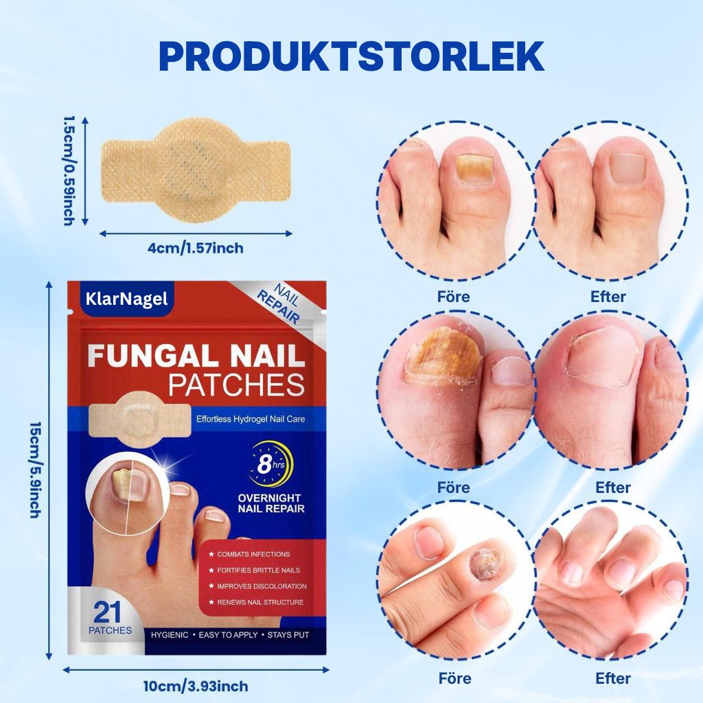 KlarNagel® | Lappar för nagelreparation