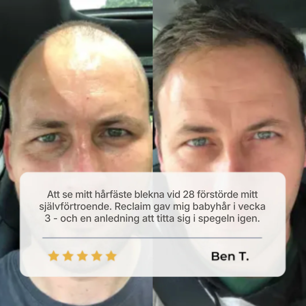 HairVital® | Roll-on-serum för hårväxt