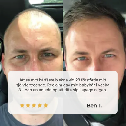 HairVital® | Roll-on-serum för hårväxt