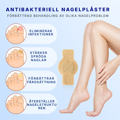 KlarNagel® | Lappar för nagelreparation