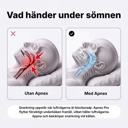 Apnex Pro® | Får snarkningen att upphöra redan från första natten
