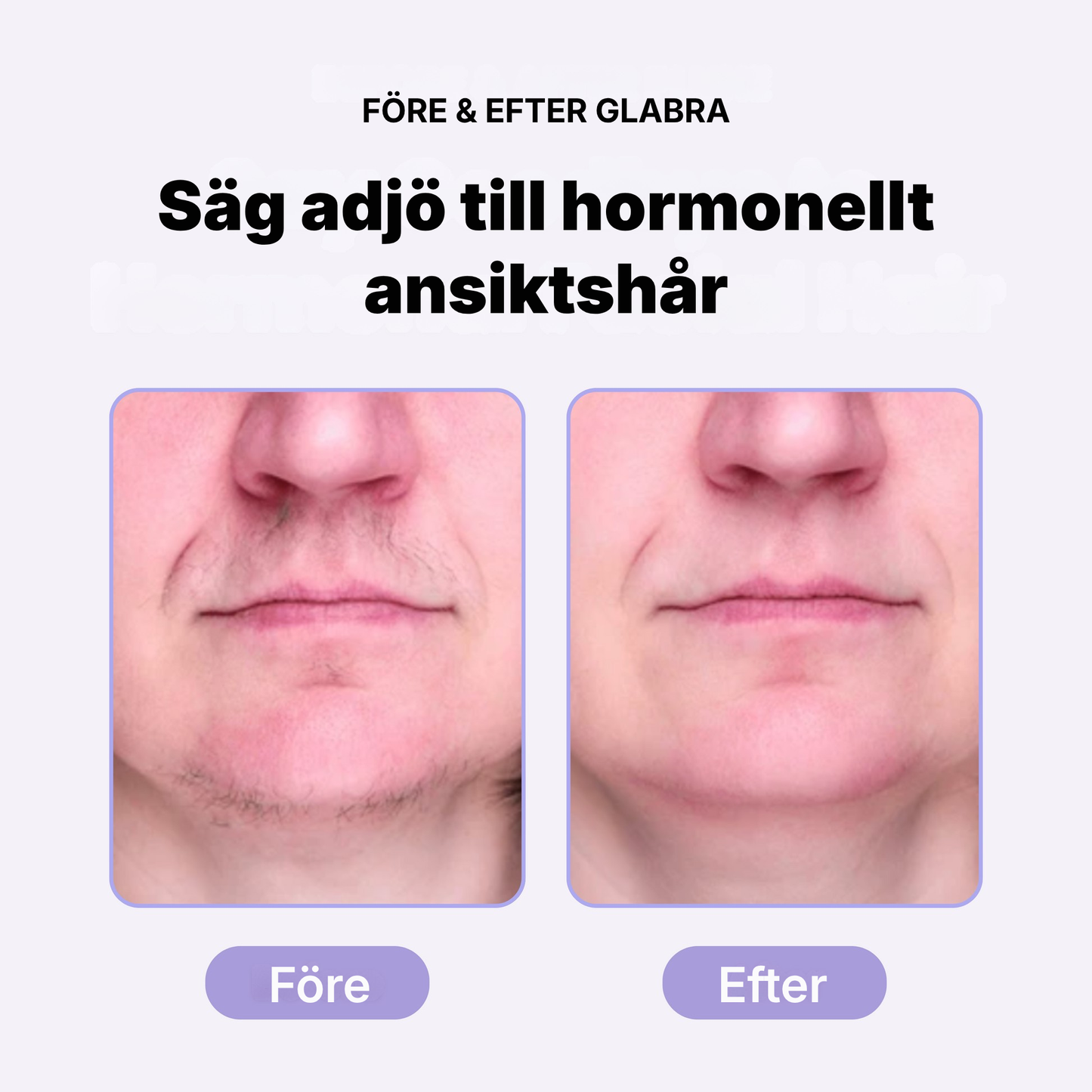 Glabra® | Effektiv hårborttagning i ansiktet utan inåtväxande hårstrån