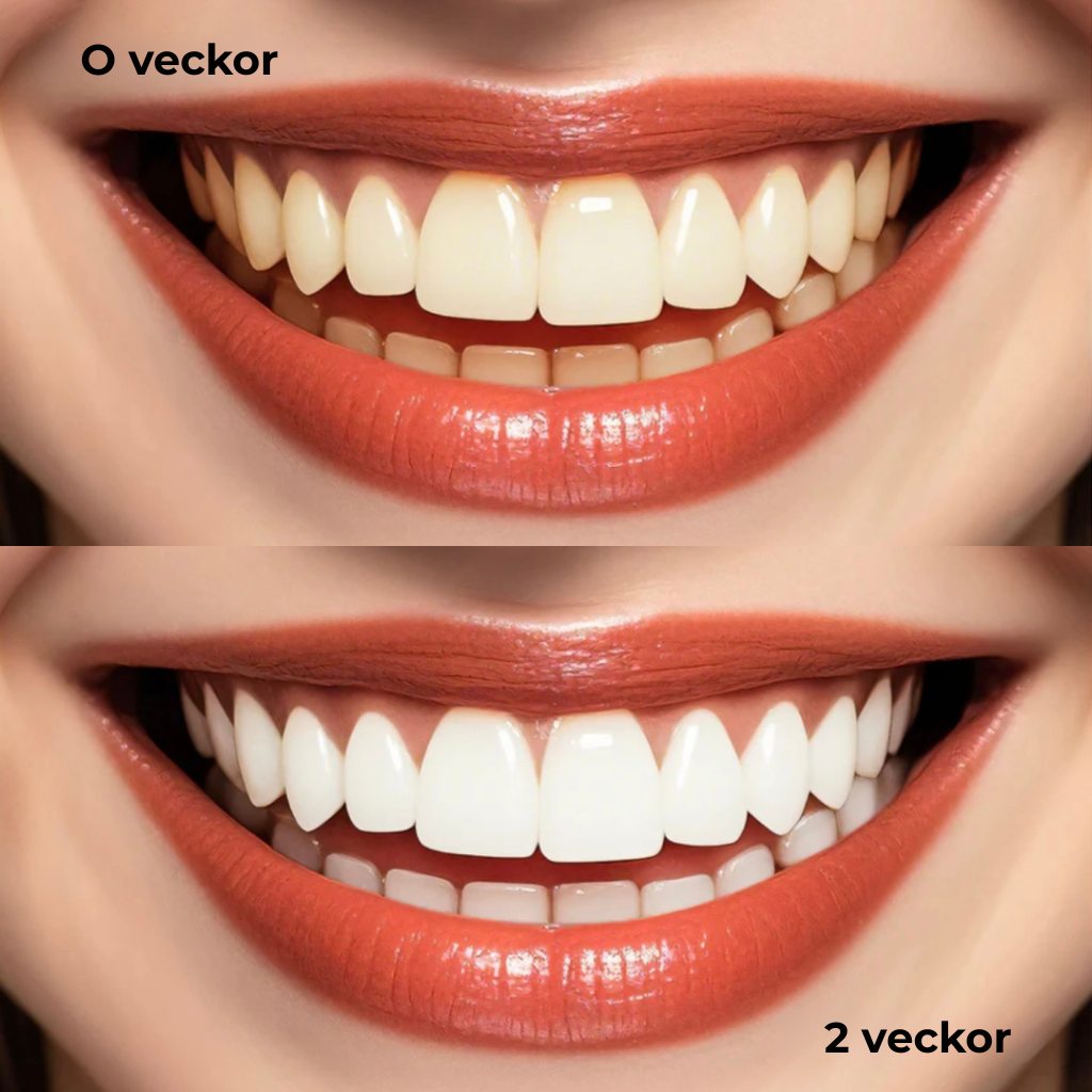 Oralux® | Tandkräm med niacinamid för vitare tänder
