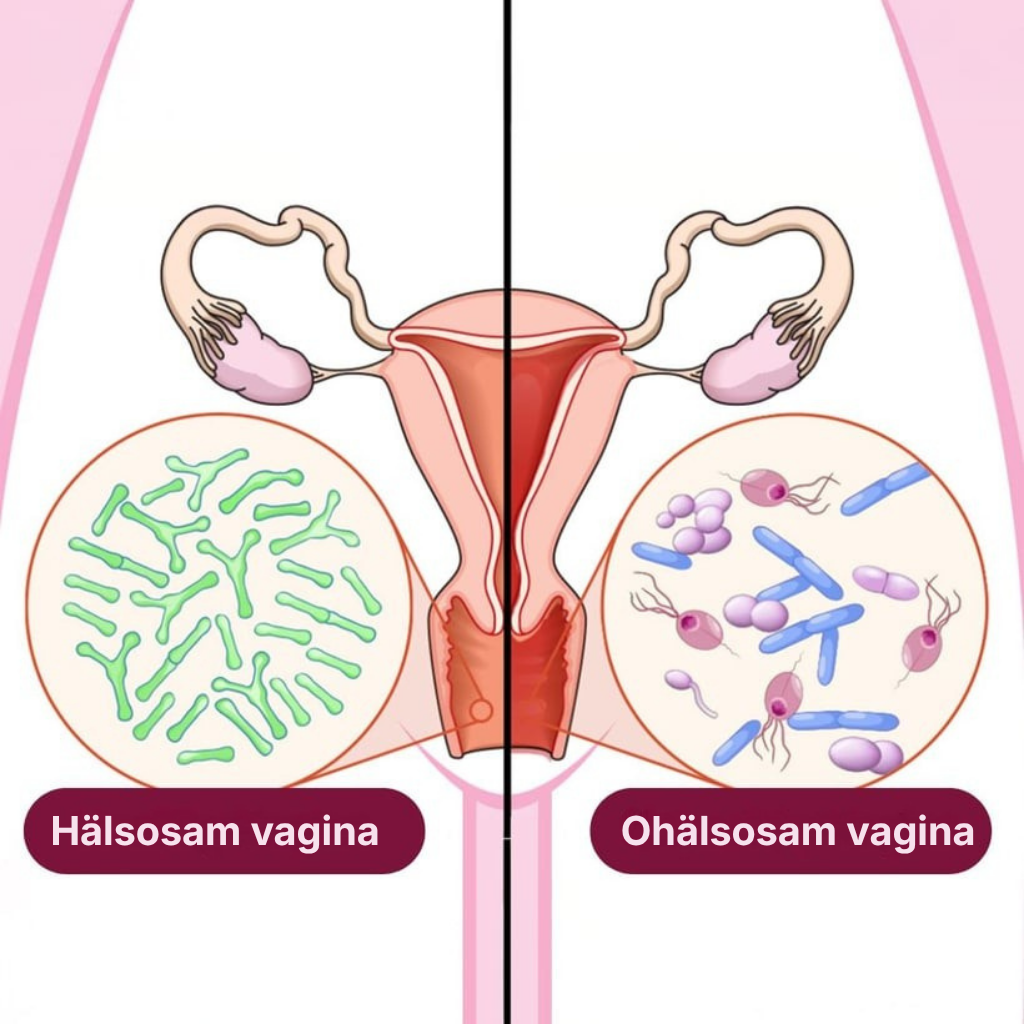 Floriva® | Tar bort obehaglig vaginal lukt och återställer din naturliga friskhet
