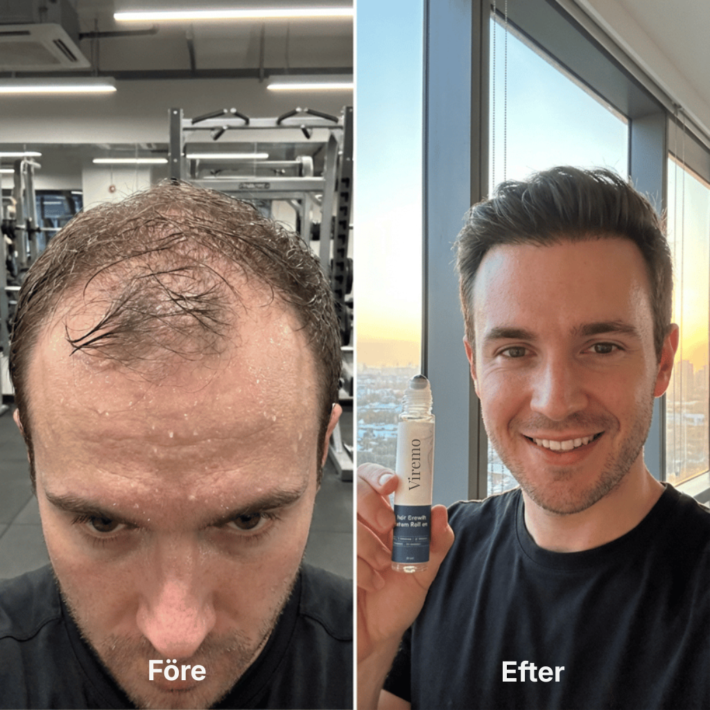 Viremo® Roll-on-serum för hårväxt