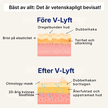 V-Lyft® | Känn dig självsäker igen med en naturligt lyft käklinje på 3 veckor