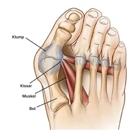 Aligna® | Tåkorrigerare