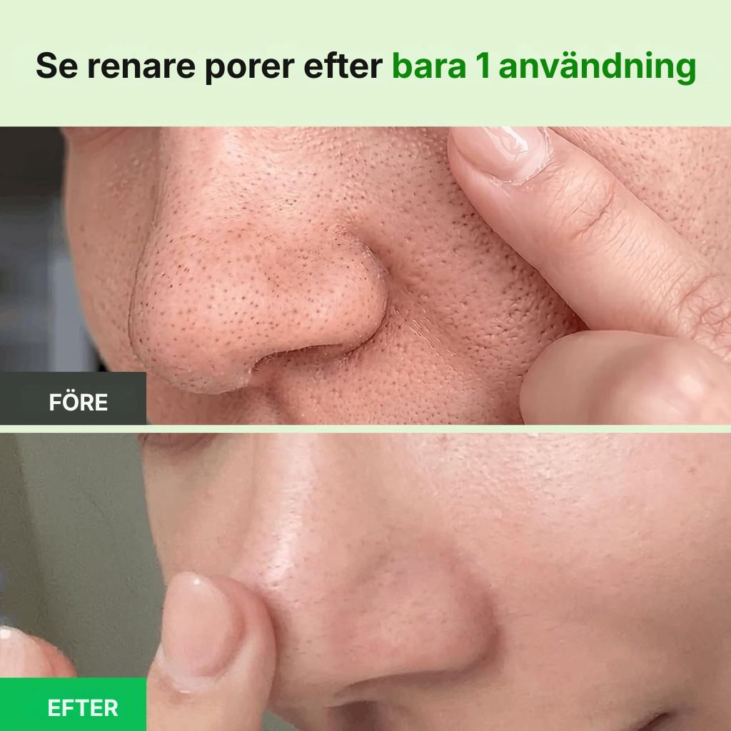 Selivo® Porengöring med grön tomat | Cardi B:s lermaskrengöring för djuprengöring av porer och porförminskning, kontroll av pormaskar och talg, mild ansiktstvätt för kvinnor, koreansk hudvård