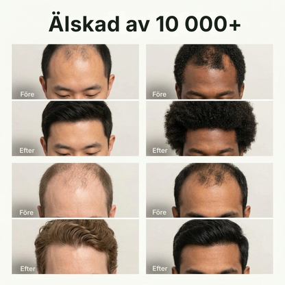 Scaluna® | Avlägsnar ansamlingar, lugnar hårbotten och främjar en sund hårväxt