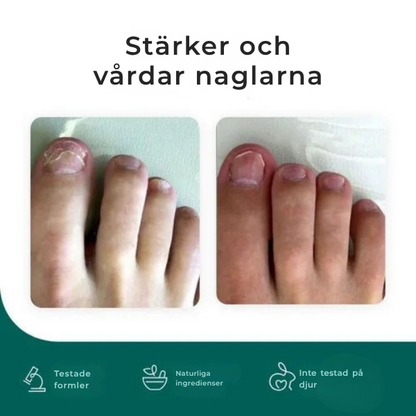 Nailura® | Nagelvårdspenna