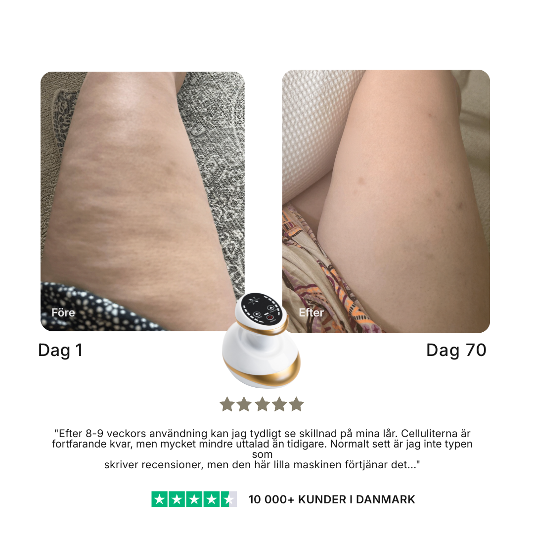 CelluSculpt® | Massageapparat mot celluliter