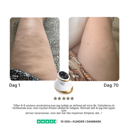 CelluSculpt® | Massageapparat mot celluliter