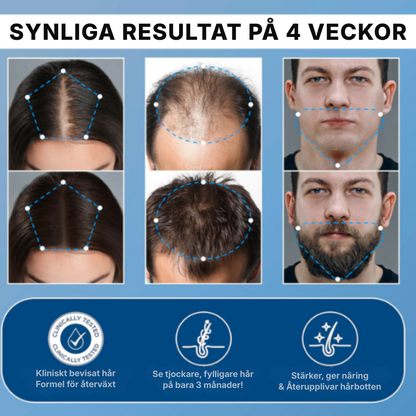 Capora® | Roll-on-serum för hårväxt