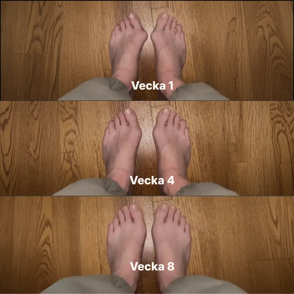 Aligna® | Tåkorrigerare
