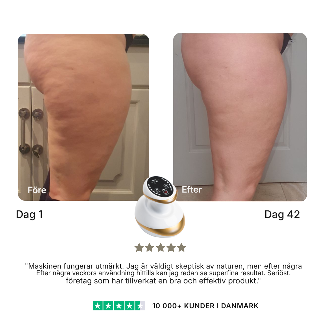 CelluSculpt® | Massageapparat mot celluliter