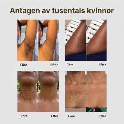 Virelle® | Hudförbättrande kroppsprodukt med nigellaolja